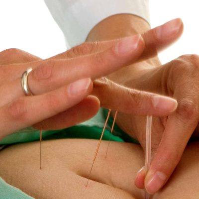 Curso de Acupuntura Abdominal Sevilla